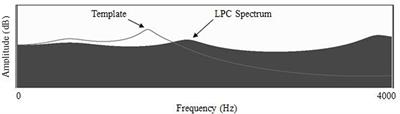 Differential Effects of Visual-Acoustic Biofeedback Intervention for Residual Speech Errors